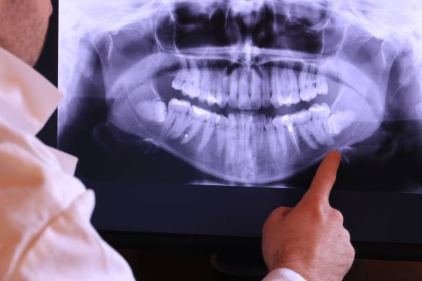 Best Emergency Dentist for Lost Fillings or Crowns in Mint Hill, NC